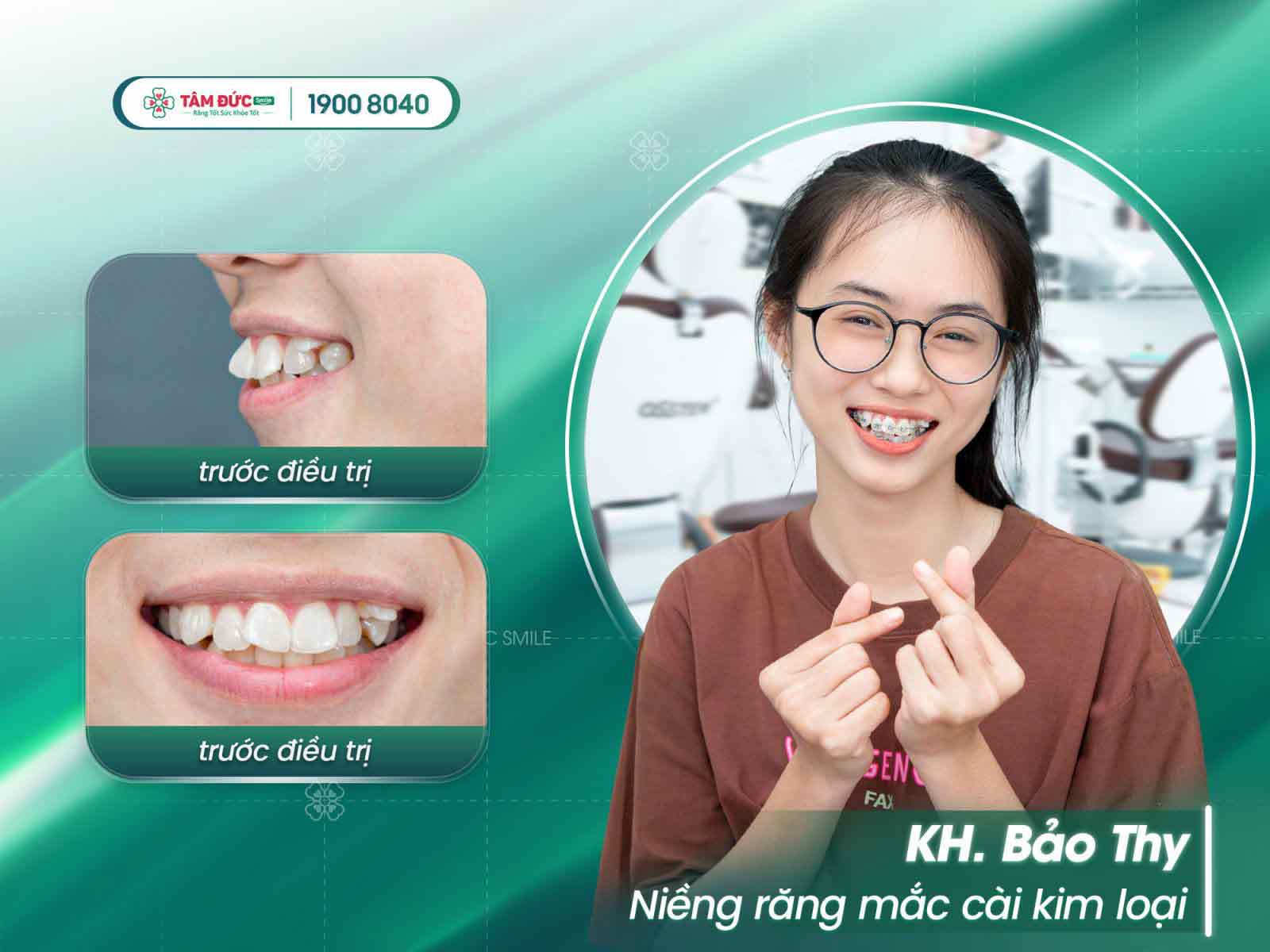 nieng-rang-mac-cai-su-thuy-hang